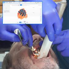 The Tech Behind Every Perfect Smile: Inside the Rise of Dental Imaging Apps